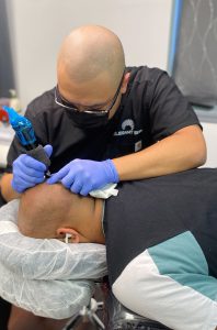 Scalp Micropigmentation