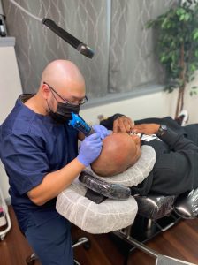 Scalp Micropigmentation in Buffalo, NY