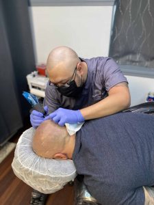 Scalp Micropigmentation clinic in Buffalo, NY