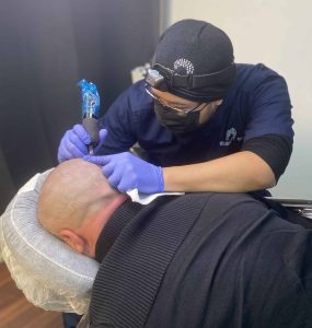 Scalp Micropigmentation clinic in Buffalo, NY