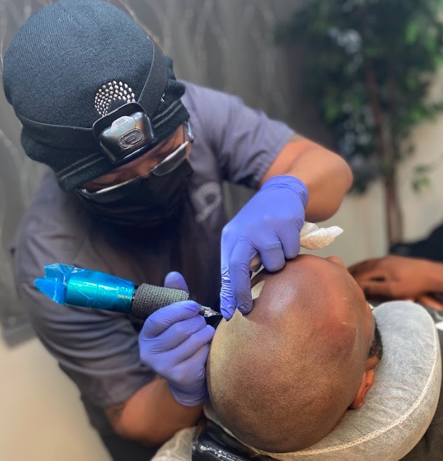 Hairline Tattoo: A Comprehensive Guide to Scalp Micropigmentation