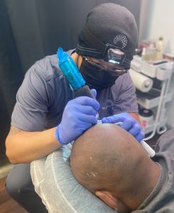 How Long Does Scalp Micropigmentation Take?