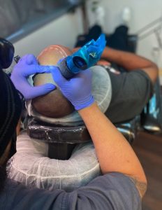 Is Scalp Micropigmentation Permanent?