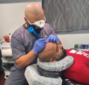 Scalp Micropigmentation for Head Scar Coverage