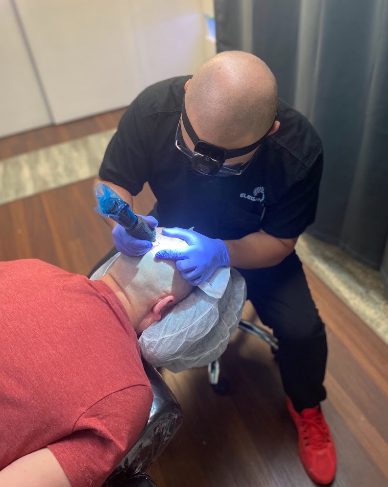 How long does it take for scalp micropigmentation to heal?