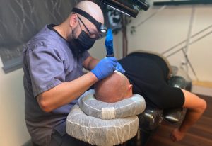 Scalp Micropigmentation