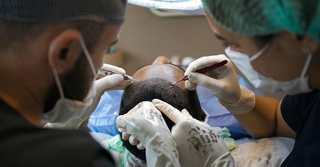 SMP for Hair Transplant Scars: FUE and FUT Coverage